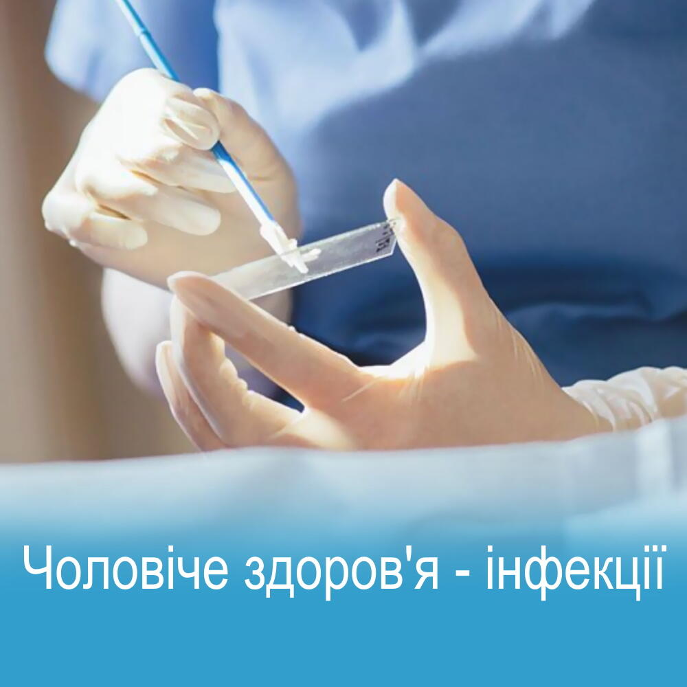 Повне медичне обстеження урологічне обстеження чоловіків на інфекції в Києві, Клініка урології Меділенд